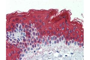 Cytokeratin 1 antibody was used for immunohistochemistry at a concentration of 4-8 ug/ml. (Cytokeratin 1 Antikörper)