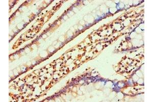 Immunohistochemistry of paraffin-embedded human small intestine tissue using ABIN7145991 at dilution of 1:100 (CCL25 Antikörper  (AA 24-150))