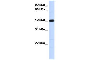 Tropomodulin 3 antibody used at 1 ug/ml to detect target protein. (TMOD3 Antikörper)