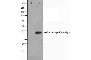 Western blot analysis on mouse heart cell lysate using KLK3 Antibody,The lane on the left is treated with the antigen-specific peptide. (Prostate Specific Antigen Antikörper  (Internal Region))
