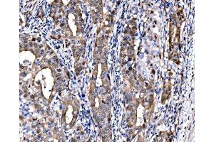 IHC analysis of DLX2 using anti-DLX2 antibody (ABIN7599936). (DLX2 Antikörper  (AA 13-310))