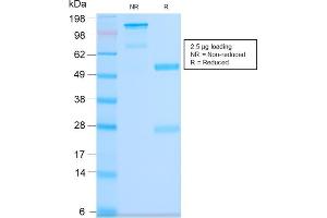 SDS-PAGE Analysis Purified CD63 Rabbit Recombinant Monoclonal Antibody (LAMP3/2990R). (Rekombinanter CD63 Antikörper)