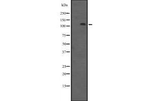 Western blot analysis of PRKD3 expression in HEK293 cells ,The lane on the left is treated with the antigen-specific peptide. (PRKD3 Antikörper  (N-Term))