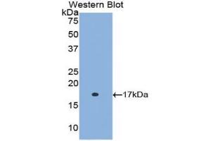 Western blot analysis of the recombinant protein. (Retinol Binding Protein 5 Antikörper  (AA 1-135))
