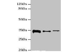 Western blot All lanes: STK16 antibody at 12 μg/mL Lane 1: A549 whole cell lysate Lane 2: Mouse brain tissue Lane 3: A431 whole cell lysate Secondary Goat polyclonal to rabbit IgG at 1/10000 dilution Predicted band size: 35 kDa Observed band size: 35 kDa
