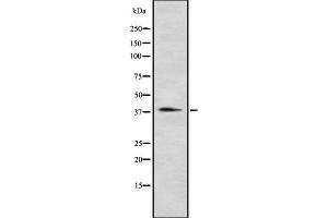 Western blot analysis of P2RY12 using Jurkat whole cell lysates (P2RY12 Antikörper  (N-Term))