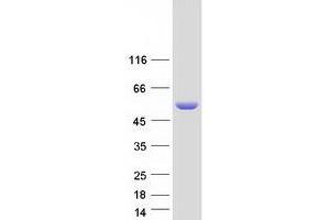 Western Blotting (WB) image for S-Antigen, Retina and Pineal Gland (Arrestin) (SAG) protein (Myc-DYKDDDDK Tag) (ABIN2731282)