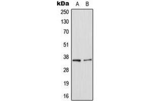 Western blot analysis of Galectin 8 expression in HepG2 (A), NIH3T3 (B) whole cell lysates.