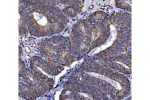 IHC analysis of SARS2 using anti-SARS2 antibody (ABIN7601804).