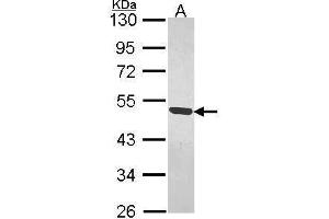 WB Image Sample (30 ug of whole cell lysate) A: H1299 10% SDS PAGE MAGEB1 antibody antibody diluted at 1:1000 (MAGEB1 Antikörper  (Center))