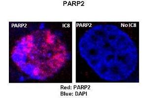 Sample Type :  Rat thyrocytes-FRTL-5   Primary Antibody Dilution :   1:100   Secondary Antibody :  Anti-rabbit-Texas Red   Secondary Antibody Dilution :   1:100   Color/Signal Descriptions :  Red: PARP2 Blue: DAPI   Gene Name :  P Submitted by :  Syed A Morshed, Mount Sinai School of Medicine and James J Peters VA Medical Center (PARP2 Antikörper  (Middle Region))