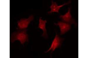 ABIN6267535 staining A2780 by IF/ICC. (CDKN1B Antikörper  (pSer10))