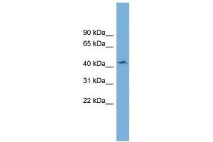 Western Blotting (WB) image for anti-UDP-Gal:betaGlcNAc beta 1,4- Galactosyltransferase, Polypeptide 3 (B4GALT3) (N-Term) antibody (ABIN635880)