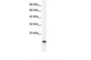 Image no. 2 for anti-C-Myc Binding Protein (MYCBP) (C-Term) antibody (ABIN202015)