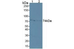 Western blot analysis of (1) Human MCF7 Cells and (2) Human A431 Cells. (MMP2 Antikörper  (AA 110-660))