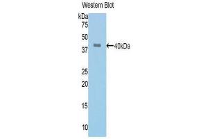 Western Blotting (WB) image for anti-Angiotensin I Converting Enzyme (Peptidyl-Dipeptidase A) 1 (ACE) (AA 504-597) antibody (ABIN1171910) (Angiotensin I Converting Enzyme 1 Antikörper  (AA 504-597))