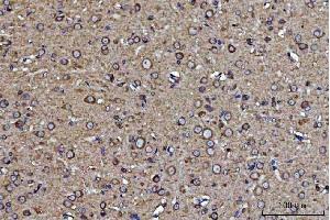 IHC analysis of GRP94 using anti-GRP94 antibody (ABIN3042463).