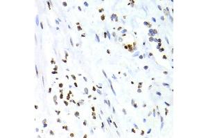 Immunohistochemistry of paraffin-embedded human vermiform appendix using NFKB2 Antibody (ABIN1873900) at dilution of 1:100 (40x lens). (NFKB2 Antikörper)