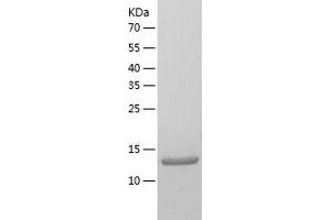 Western Blotting (WB) image for Ribosomal Protein S14 (RPS14) (AA 1-151) protein (His tag) (ABIN7124893) (RPS14 Protein (AA 1-151) (His tag))