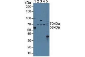Western blot analysis of (1) Human Serum, (2) Porcine Liver Tissue, (3) Porcine Brain Tissue, (4) Porcine Kidney Tissue and (5) Mouse Liver Tissue. (STAM2 Antikörper  (AA 1-377))