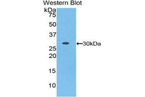 Detection of Recombinant LRRC32, Mouse using Polyclonal Antibody to Leucine Rich Repeat Containing Protein 32 (LRRC32)