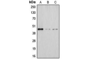 Western blot analysis of DHPS expression in Jurkat (A), JAR (B), HeLa (C) whole cell lysates. (DHPS Antikörper  (Center))