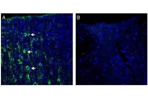 Expression of MAGT1 in rat cortex. (MAGT1 Antikörper  (Extracellular, N-Term))