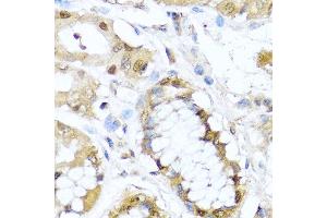 Immunohistochemistry of paraffin-embedded human stomach using TET2 antibody at dilution of 1:100 (40x lens). (TET2 Antikörper)