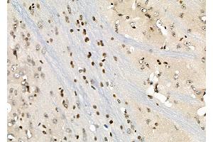 ABIN6258846 and ABIN6274264 at 1/100 staining Rat brain tissue by IHC-P. (HOXA1 Antikörper  (Internal Region))