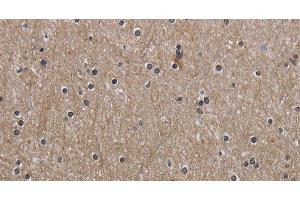 Immunohistochemistry of paraffin-embedded Human brain using PPAT Polyclonal Antibody at dilution of 1:50