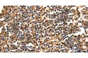 Immunohistochemistry of paraffin-embedded Human tonsil using ANXA5 Polyclonal Antibody at dilution of 1:40 (Annexin V Antikörper)