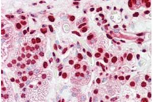 Anti-HnRNP K antibody IHC staining of human adrenal. (HNRNPK Antikörper  (AA 1-50))