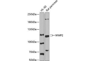 Western blot analysis of extracts of various cell lines, using WWP2 antibody (ABIN6128368, ABIN6150276, ABIN6150277 and ABIN6222535) at 1:1000 dilution. (WWP2 Antikörper  (AA 1-270))