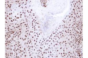 IHC-P Image Immunohistochemical analysis of paraffin-embedded Cal27 xenograft, using NHP2-like protein 1, antibody at 1:100 dilution. (NHP2L1 Antikörper  (full length))