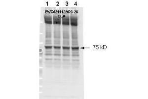 Affinity purified phospho-specific antibody to NF2 (Merlin) at pS518 was used at a 1:1000 dilution to detect NF2 by Western blot. (Merlin Antikörper  (pSer518))
