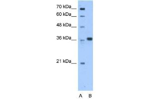 WB Suggested Anti-AASDHPPT Antibody Titration:  0.