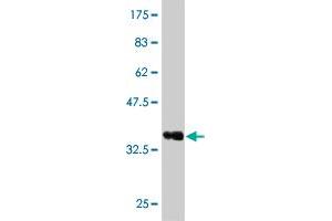 Western Blot detection against Immunogen (36. (Recoverin Antikörper  (AA 101-199))