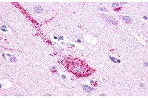 Anti-GPR61 antibody  ABIN1048846 IHC staining of human brain, neurons and glia. (GPR61 Antikörper  (N-Term))