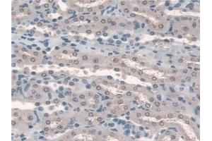Immunohistochemistry (IHC) image for anti-Hermansky-Pudlak Syndrome 4 (HPS4) (AA 20-214) antibody (ABIN7443896)