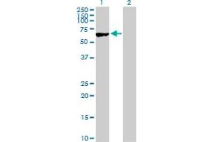 Western Blot analysis of MYBPH expression in transfected 293T cell line by MYBPH MaxPab polyclonal antibody. (MYBPH Antikörper  (AA 1-477))