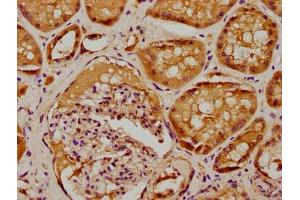 IHC image of ABIN7169172 diluted at 1:100 and staining in paraffin-embedded human kidney tissue performed on a Leica BondTM system. (Sbk2 Antikörper  (AA 62-330))