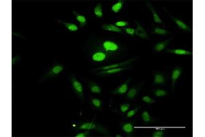 Immunofluorescence of purified MaxPab antibody to PTMS on HeLa cell. (Parathymosin Antikörper  (AA 1-102))
