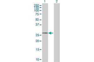 Western Blot analysis of SLC25A5 expression in transfected 293T cell line by SLC25A5 MaxPab polyclonal antibody. (SLC25A5 Antikörper  (AA 1-298))