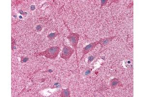 Anti-NUMB antibody IHC of human brain, cortex. (NUMB Antikörper  (AA 1-214))