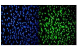 IF analysis of USP16 using anti-USP16 antibody (ABIN7602640). (USP16 Antikörper  (AA 9-823))
