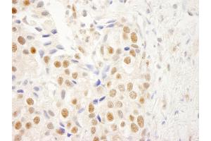 Immunohistochemistry (IHC) image for anti-Nuclear Receptor Binding Factor 2 (NRBF2) (AA 125-175) antibody (ABIN7448699) (NRBF2 Antikörper  (AA 125-175))