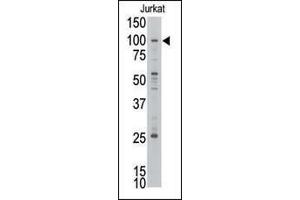 MLLT10 Antikörper  (C-Term)