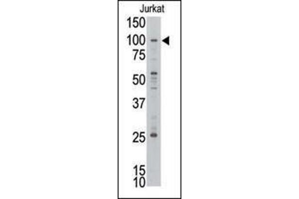 MLLT10 Antikörper  (C-Term)