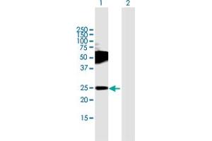 Western Blot analysis of TMEM123 expression in transfected 293T cell line by TMEM123 MaxPab polyclonal antibody. (TMEM123 Antikörper  (AA 1-208))