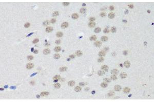 Immunohistochemistry of paraffin-embedded Mouse brain using CTCF Polyclonal Antibody at dilution of 1:200 (40x lens). (CTCF Antikörper)